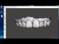 Introduction to using free dental 3d modeling software  viewing stl files