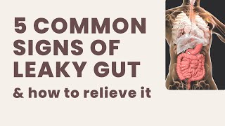 5 Common Signs of Leaky Gut (\& how to relieve it)