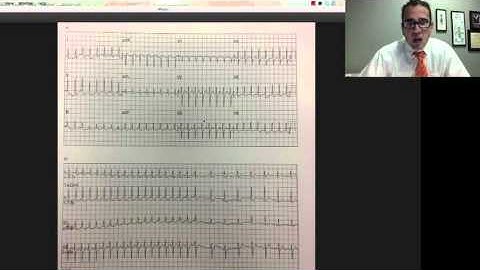 EKG EMS lecture part 1