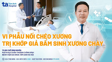 Vi phẫu nối chéo xương trị khớp giả bẩm sinh xương chày | TS.BS Chế Đình Nghĩa | CTCH Tâm Anh
