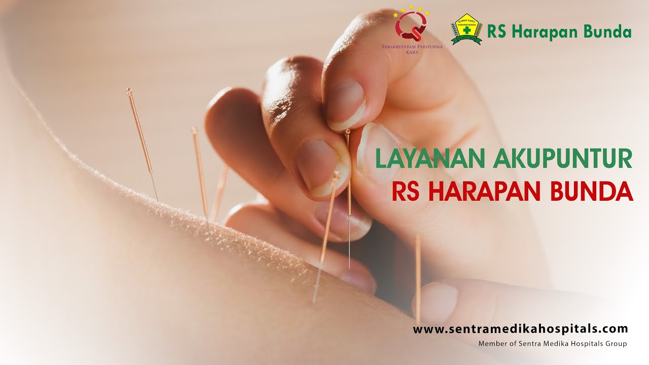 Mengenal Akupunktur Medik, Akupunktur bisa untuk pengobatan apa saja? | RS Harapan Bunda