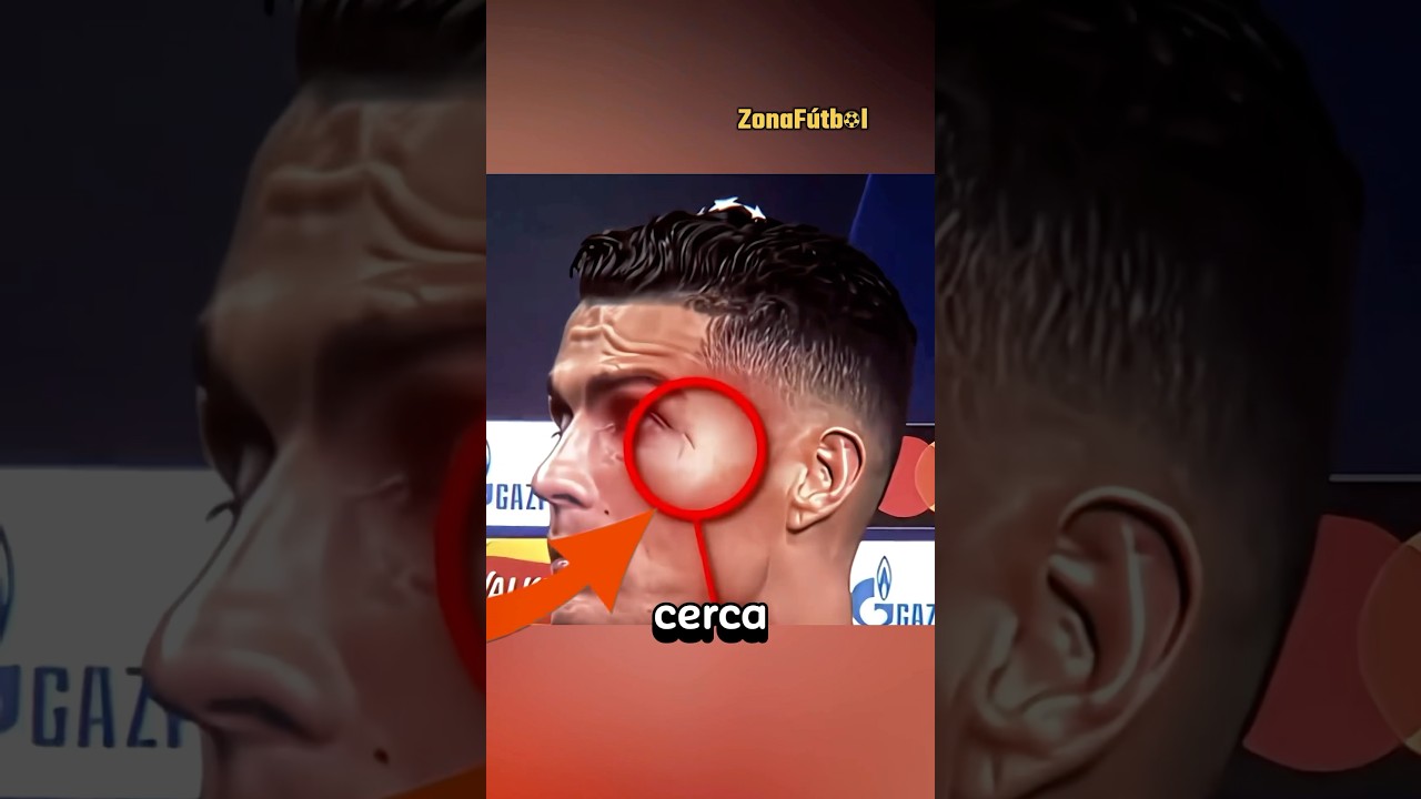 UNA LESIÓN QUE PUDO ACABAR CON LA CARRERA DE RONALDO 😳💔 ¡LA PEOR DE TODAS! 💔