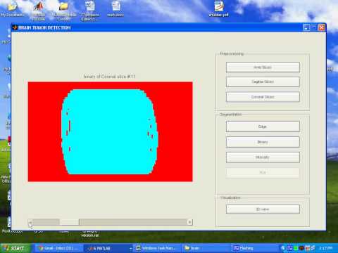 Brain Tumor Detection based on Multi parameter MRI Image Analysis