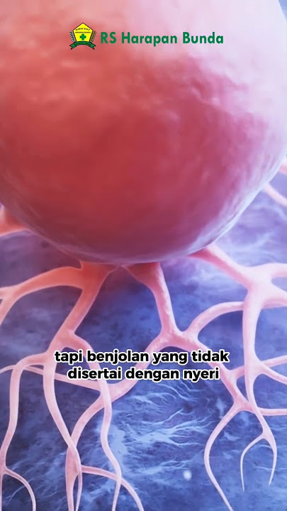 Gejala Kanker Payudara #kankerpayudara #breastcancer #cancer #kanker