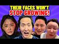 Faces Won't Stop Growing! China's Bubble Face Disaster - Plastic Surgeon Reacts