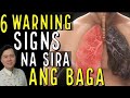 6 Warning Signs ng Sakit sa Baga (Lungs) - Payo ni Doc Willie Ong