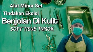 Alat untuk tindakan Eksisi pada Benjolan di Kulit (Soft Tissue Tumor) screenshot 2