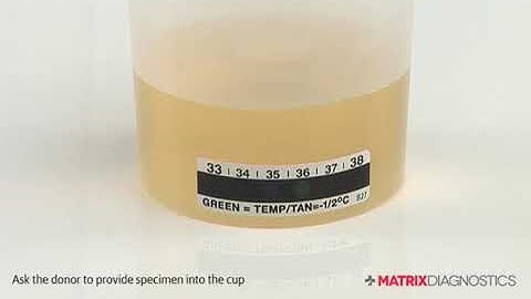 Matrix Diagnostics - How to Use Your Urine Back to Lab Test