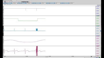 Dual-Channel MRI Gating Systems | DTU200/300 Data