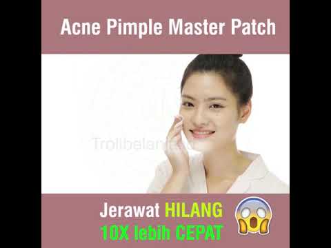 Acne Pimple Master Patch Troli id