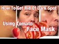 How To Get Rid Dark Spot Using Tomato Face Mask