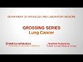 Grossing lung pathology specimens  department of pathology and laboratory medicine