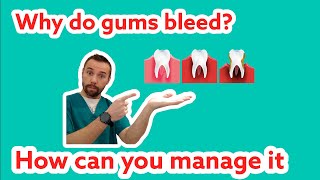 Famous Dentist teaches patients: bleeding of the gums and how to stop it Profile