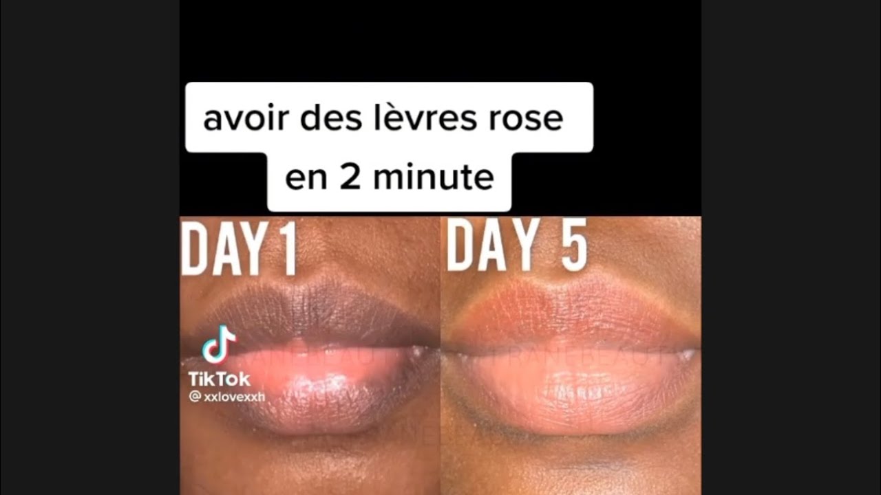 Comment avoir les lèvres roses naturellement - YouTube