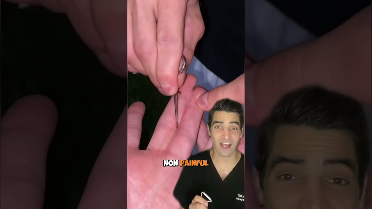 Fingers Stuck Together