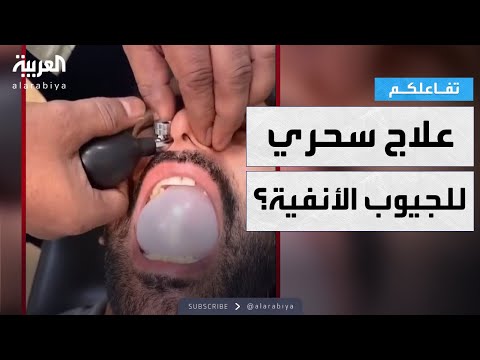 تفاعلكم ترند تنظيف الجيوب الأنفية علاج سحري