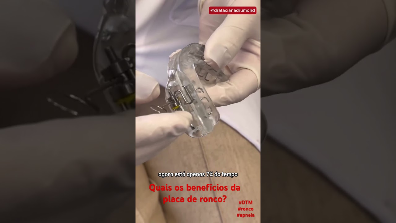 Quais os benefícios da Placa de Ronco? #ronco #apneiadosono  #apneia #tratamento #odontologiadosono