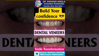 My Smile is Embarrassing! #glowup #smile #smilemakeover #smilemore #smileforever #veneers #dental