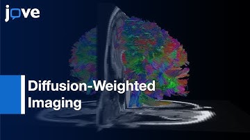 Co-analysis: Brain Structure & Function By fMRI & Diffusion-Weighted Imaging l Protocol Preview