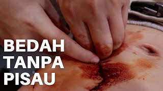 BONGKAR ILMU DUKUN (BEDAH TANPA TANPA PISAU) - OPERASI GHAIB GUS SAMSUDIN #rynku