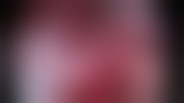 Uniportal vats intrapericardial right pneumonectomy