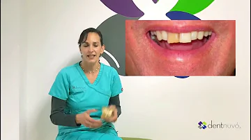 ¿Se puede recuperar el color de los dientes?