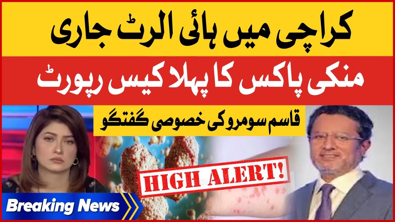 High Alert In Karachi | Monkeypox First Case Report | Qasim Somoroo ...