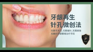 牙齦萎縮不用著急，針孔微創治療法輕鬆使牙齦再生