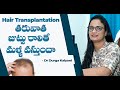 Hair loss after hair transplantation will it regrow   keha skin  hair clinic  dr durga kalyani