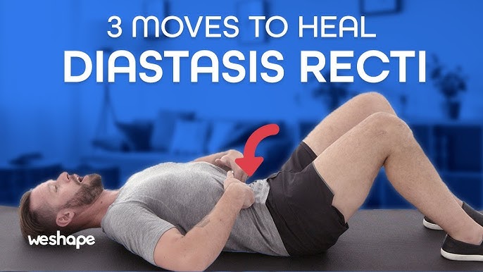 Heal Diastasis Recti FAST – Physiotherapy Guide to FIX & FLATTEN