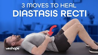 3 Moves To Heal Diastasis Recti