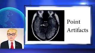 Mri And Factors Impact Image Quality - Final Exam