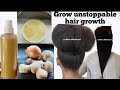 HOW TO USE ONION GARLIC & GINGER JUICE FOR UNSTOPPABLE HAIR GROWTH! How to make onion garlic &ginger