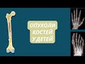 Опухоли Костей у Детей