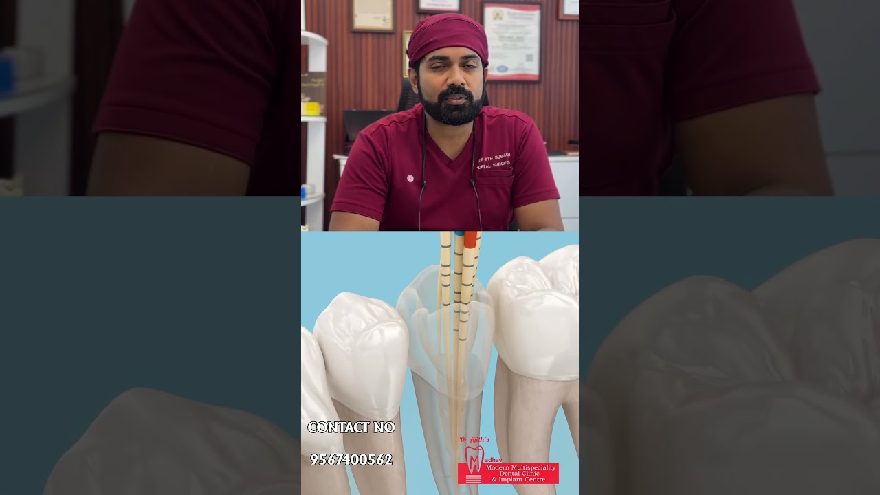 Root Canal Treatment YouTube thumbnail