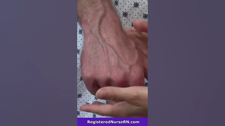 This Vein is Going to Roll... Nurse IV Insertion Tips #shorts - DayDayNews
