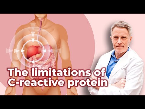The limitations of
