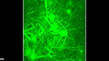 Deverman et al., Nature Biotechnology, 2016