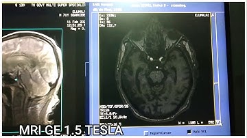 MRI BRAIN PROTOCOL~SEQUENCES | GE 1.5 TESLA