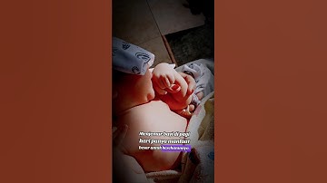 Mengatasi Bayi Kuning | #baby #newborn #bayi #edukasi