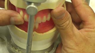 Mandibular Anterior  Set up