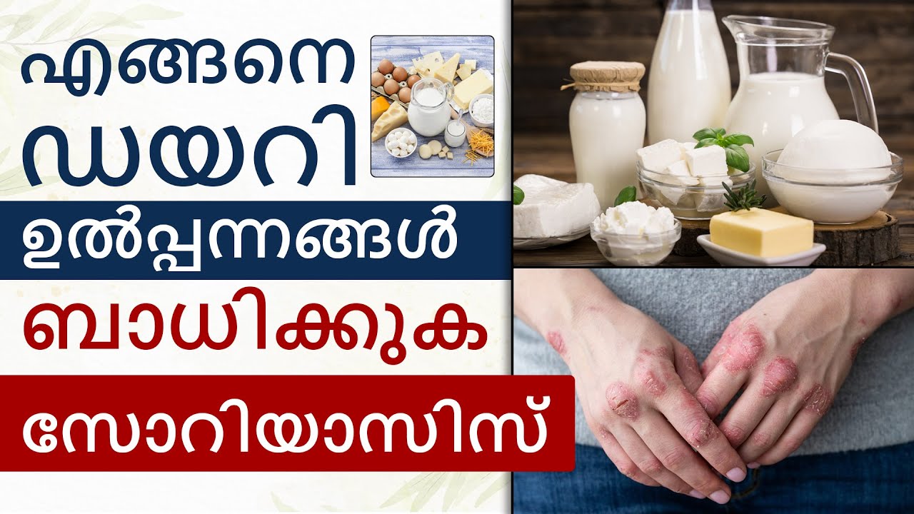 പാലുൽപ്പന്നങ്ങൾ സോറിയാസിസിനെ എങ്ങനെ ബാധിക്കുന്നു Is Milk Good or Bad for Psoriasis Patient