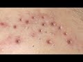 Satisfying Relaxing With Sac Dep Spa Video 156 Satisfying Relaxing With Sac Dep Spa Video 156