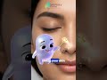 ✨ Medifacial Glow-Up Revealed! 💧 | The Medical Facial Your Skin Actually Needs