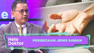 Perbezaan Jenis Sawan | Helo Doktor (6 Aug 2023)