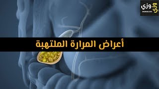 أهم أعراض المرارة الملتهبة