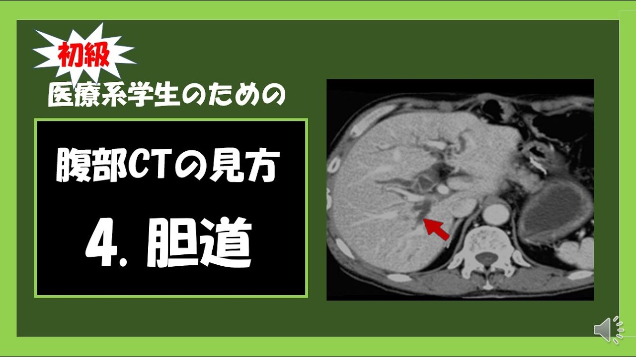 腹部のCT