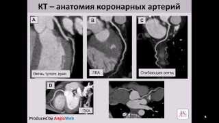 Компьютерная томография сердца или КТ-коронарография(http://www.symptominfo.ru/article/doc/126/ или http://www.medglobus.ru/Medarticles-Angiology-Computed%20Tomography%20Angiogram.htm Здесь Вы ..., 2012-09-23T19:23:06.000Z)