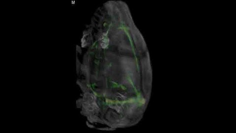 3D Reconstruction (µCT) of Cerebral Vasculature Acquired In Vivo Following Injection of Mvivo Au