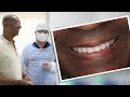 Eu queria Implantes Dentários sem Enxerto, Rápido e com Segurança!